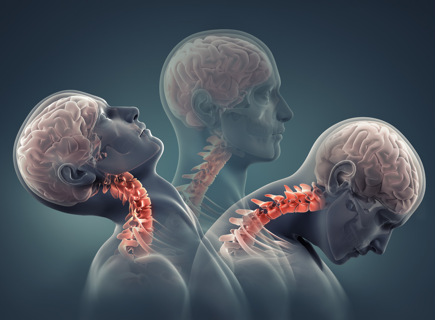 man x-ray with neck bones highlighted